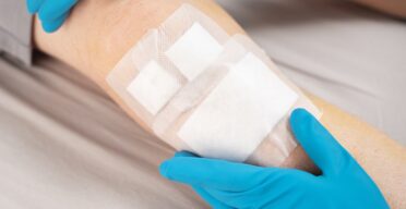 A Robust Senescence Response Helps Wounds Heal