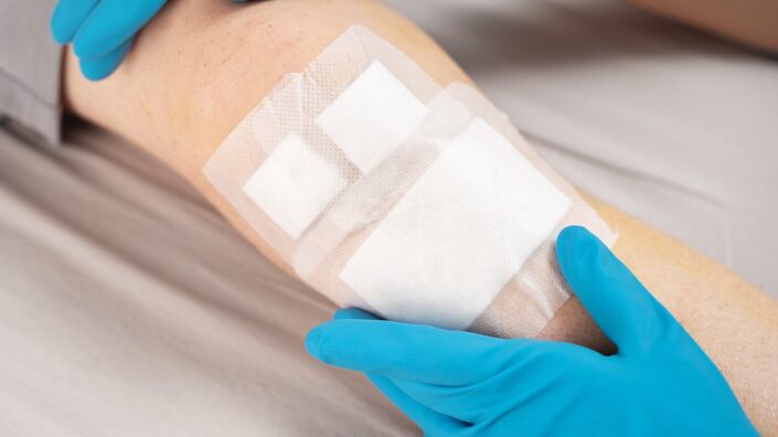 Wound healing