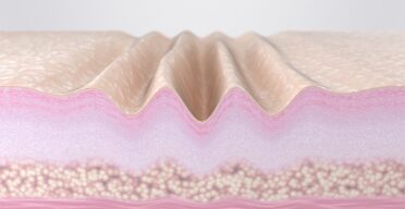 Why Fast-Cycling Skin Cells Decrease With Age