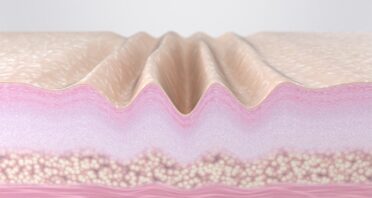 Why Fast-Cycling Skin Cells Decrease With Age