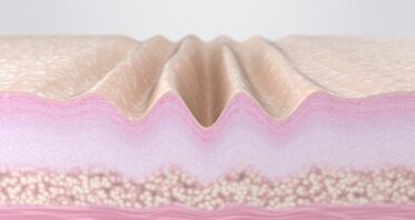 Why Fast-Cycling Skin Cells Decrease With Age