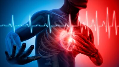 Heart attack