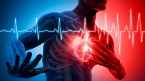 Heart attack
