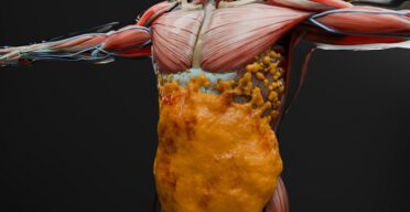 GLP-1 Drugs’ Muscle Effects Similar to Ordinary Weight Loss