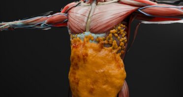 GLP-1 Drugs’ Muscle Effects Similar to Ordinary Weight Loss