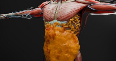 GLP-1 Drugs’ Muscle Effects Similar to Ordinary Weight Loss