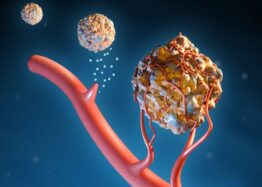 How Senescent Cells Grow the Homes of Cancerous Tumors