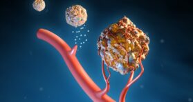 How Senescent Cells Grow the Homes of Cancerous Tumors
