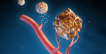 How Senescent Cells Grow the Homes of Cancerous Tumors