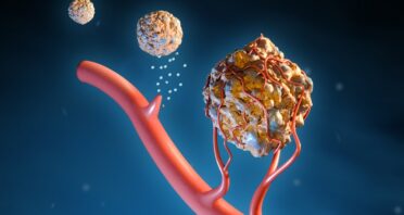 How Senescent Cells Grow the Homes of Cancerous Tumors