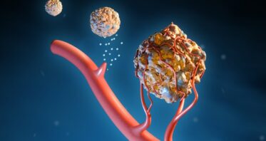 How Senescent Cells Grow the Homes of Cancerous Tumors
