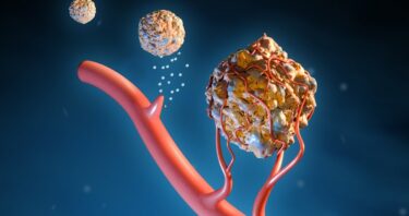 How Senescent Cells Grow the Homes of Cancerous Tumors