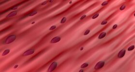 How Antioxidants Can Selectively Remove Some Senescent Cells