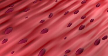 How Antioxidants Can Selectively Remove Some Senescent Cells