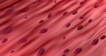 How Antioxidants Can Selectively Remove Some Senescent Cells