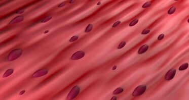 How Antioxidants Can Selectively Remove Some Senescent Cells