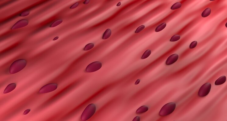 How Antioxidants Can Selectively Remove Some Senescent Cells