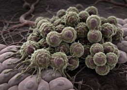 Why Turning Off Cancer Genes Doesn’t Always Work