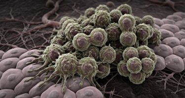 Why Turning Off Cancer Genes Doesn’t Always Work