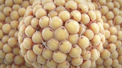 Fat cells