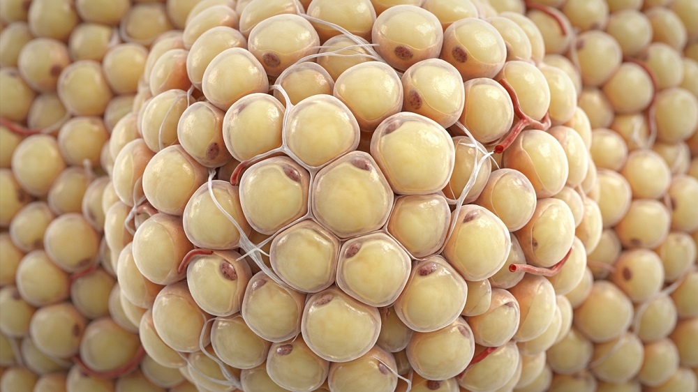 Fat cells