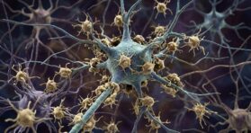 In ALS, Microglia Eat Living Neurons, Mistaking Them for Dead