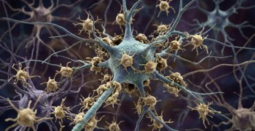 In ALS, Microglia Eat Living Neurons, Mistaking Them for Dead