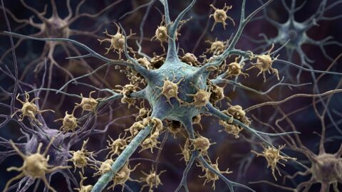 Microglia attacking a neuron