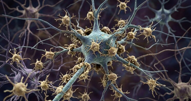 In ALS, Microglia Eat Living Neurons, Mistaking Them for Dead