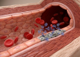 A New Metric for Overall Senescent Cell Burden