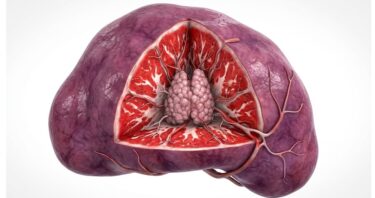 Thymus Grafts Grow in Mouse Spleens, Restoring Immunity