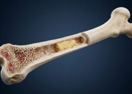 Blocking STING Helps Preserve Bone in Aging Mice