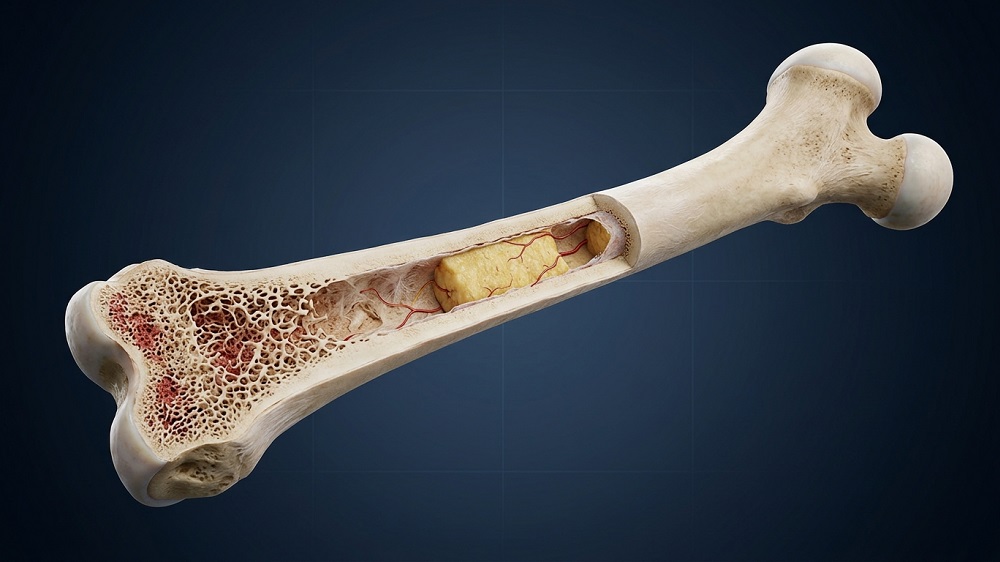 Bone structure