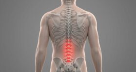 An Anti-Senescence Gene May Fight Spinal Disc Deterioration