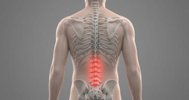 An Anti-Senescence Gene May Fight Spinal Disc Deterioration