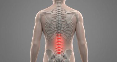 An Anti-Senescence Gene May Fight Spinal Disc Deterioration