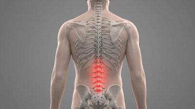 Inflamed lower back discs