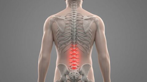 Inflamed lower back discs