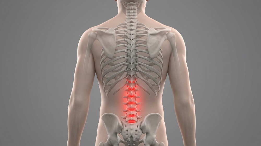Inflamed lower back discs