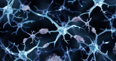 Preventing Alzheimer’s Proteins From Accumulating