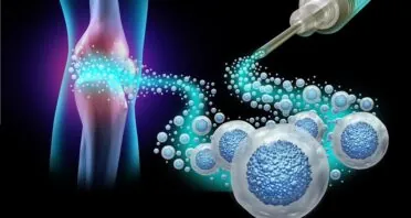 Extracellular Vesicles for Treating Arthritis